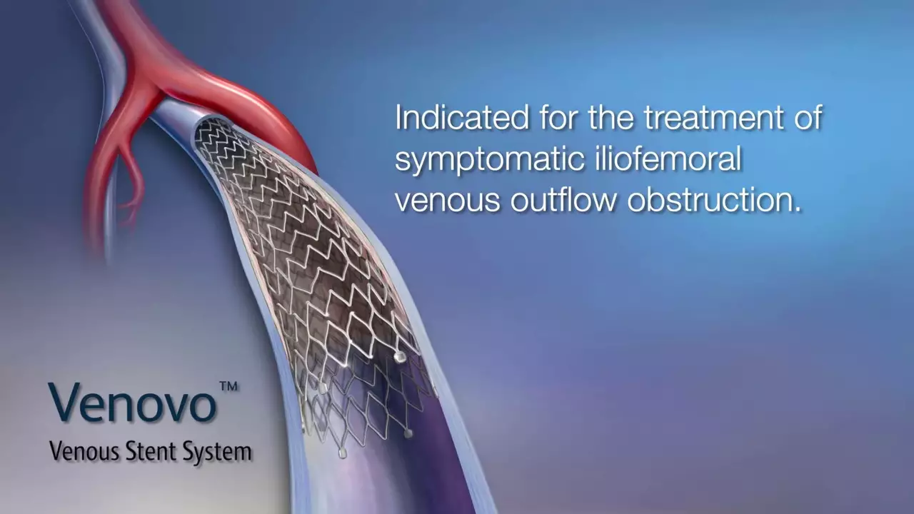 With a heart stent, can I play contact sports?
